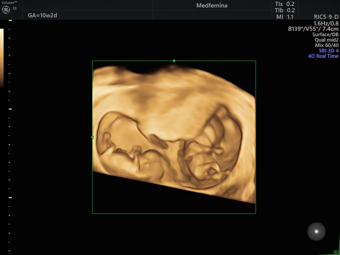 Katarzyna Mikołajczyk-6