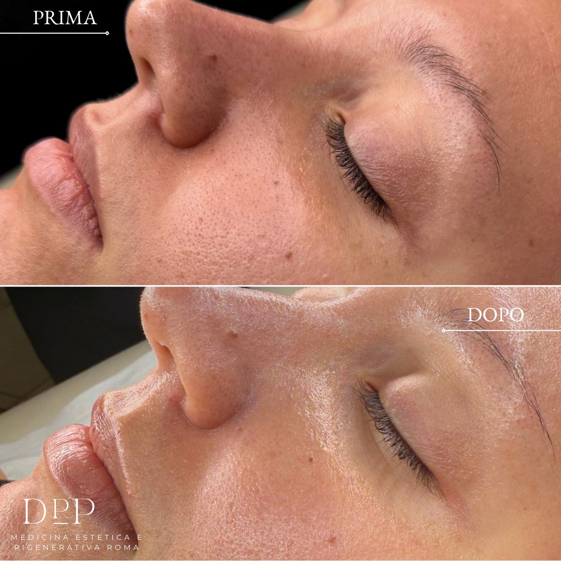 Davide Prosperi Porta-15