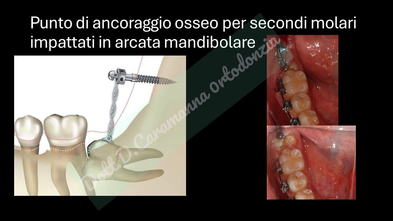 Daniele Caramanna-37