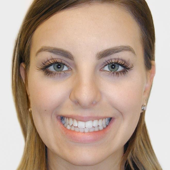 Nicola Schmidt-Rogge-8