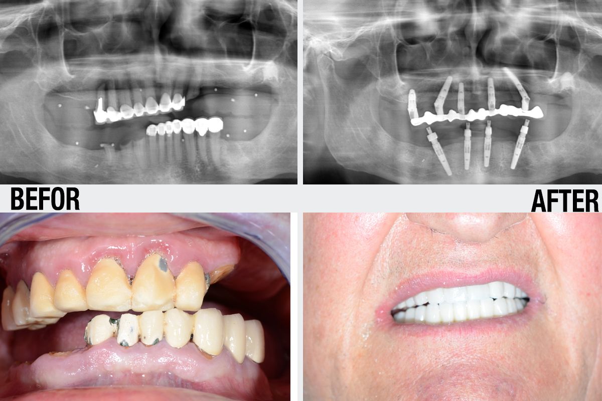 Alessandro Palumbo-32