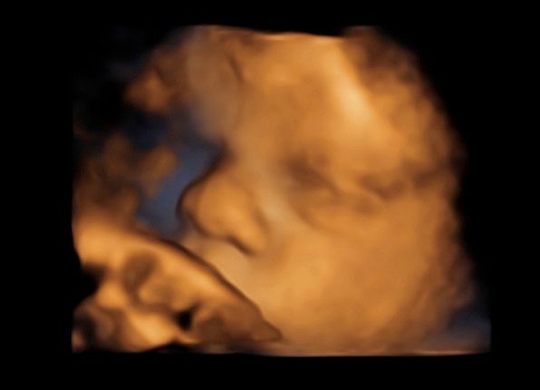 Tommaso Incandela-38