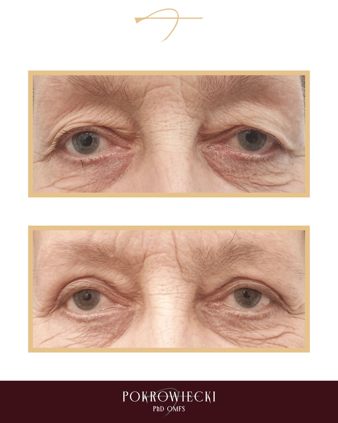 Rafał Pokrowiecki-5