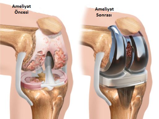 Übeydullah Sevgili-3