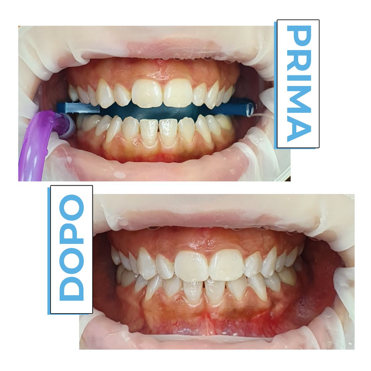 Francesco Anaclerico-16