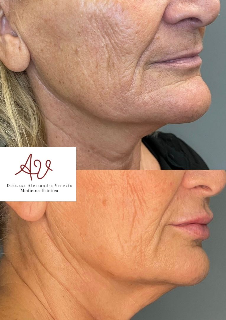 Alessandra Venezia-39