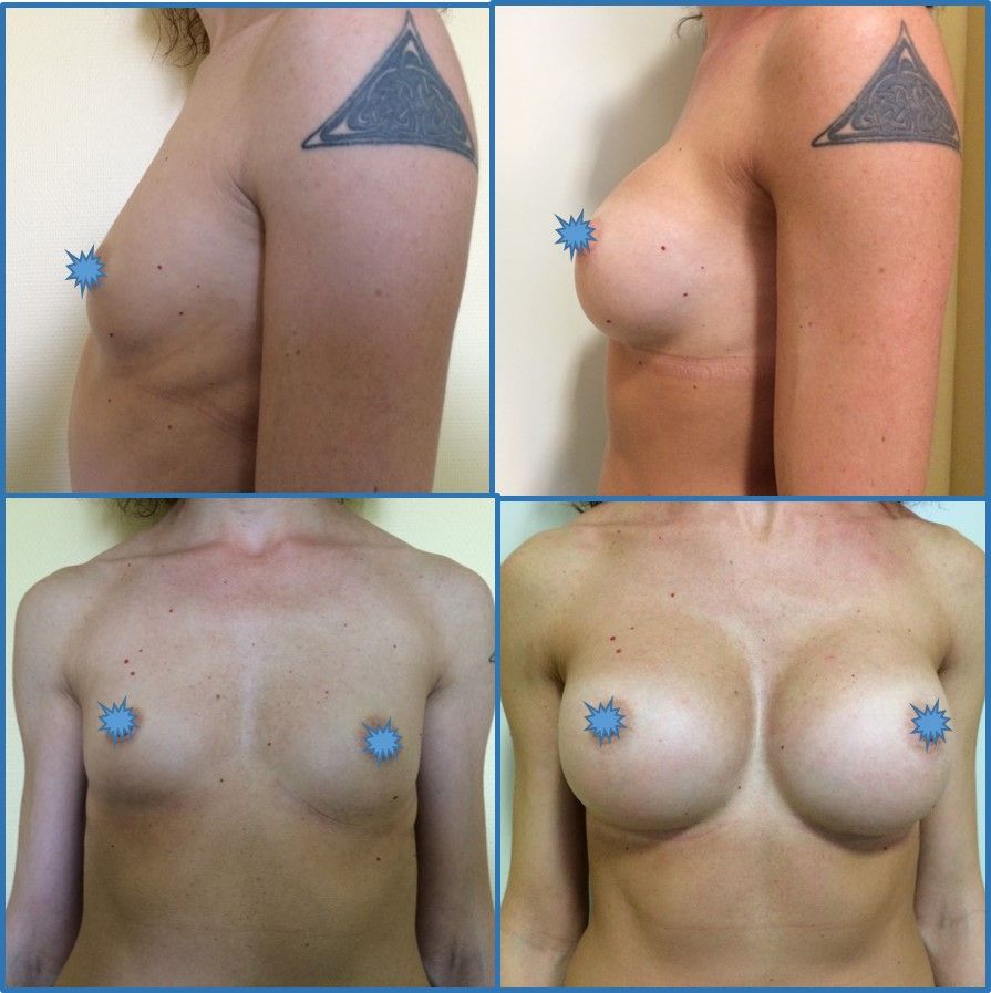 Giorgio Giovannelli-11