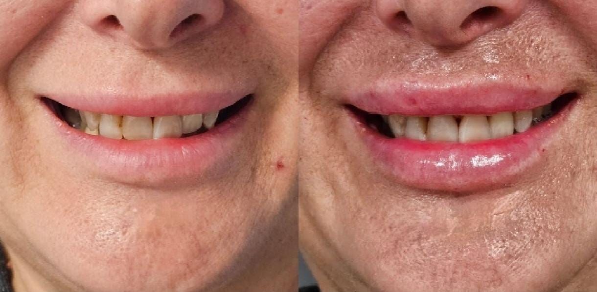 Rosalba Herrero Zerpa-573