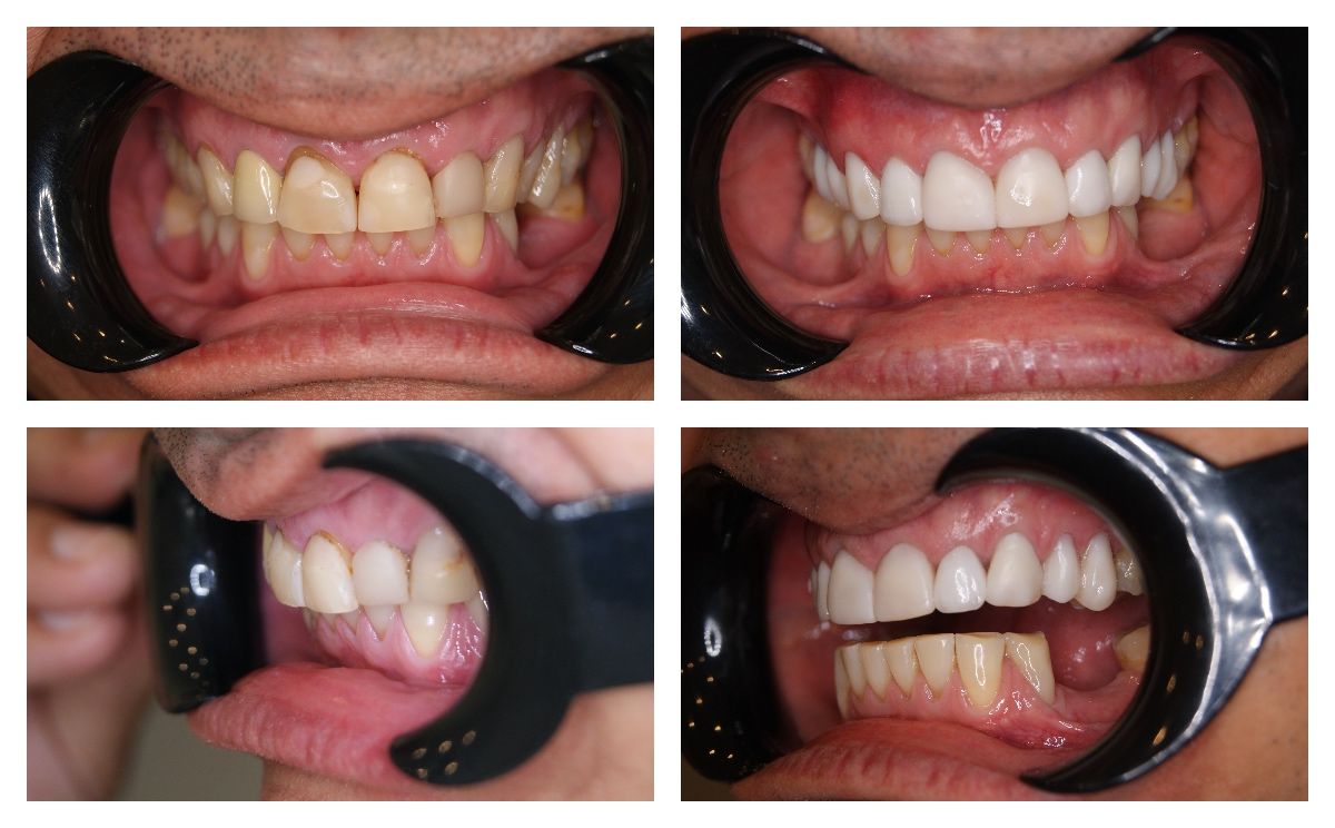 Katarzyna Konieczna-8