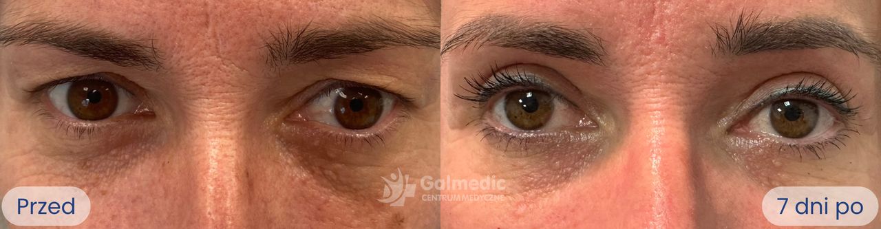 Jakub Staniszewski-0