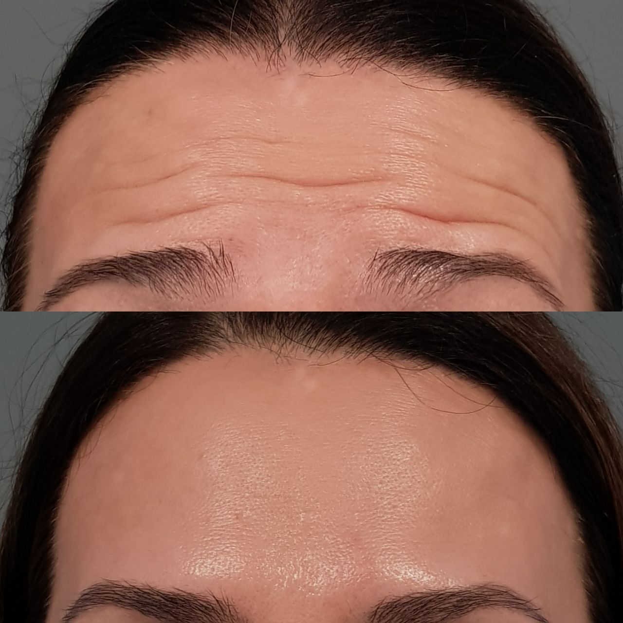 Rosalba Herrero Zerpa-198