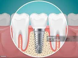 Fernando De Carlos Muñoz-0