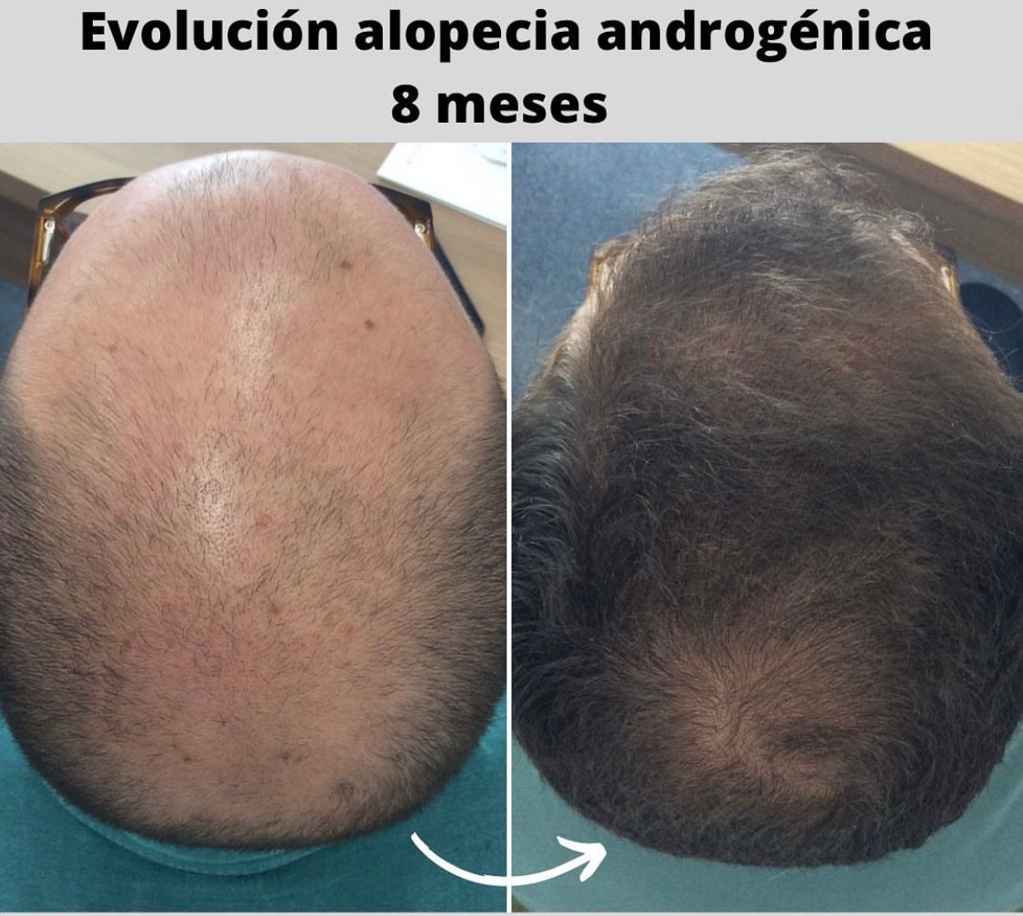 Pablo Martín Carrasco-2