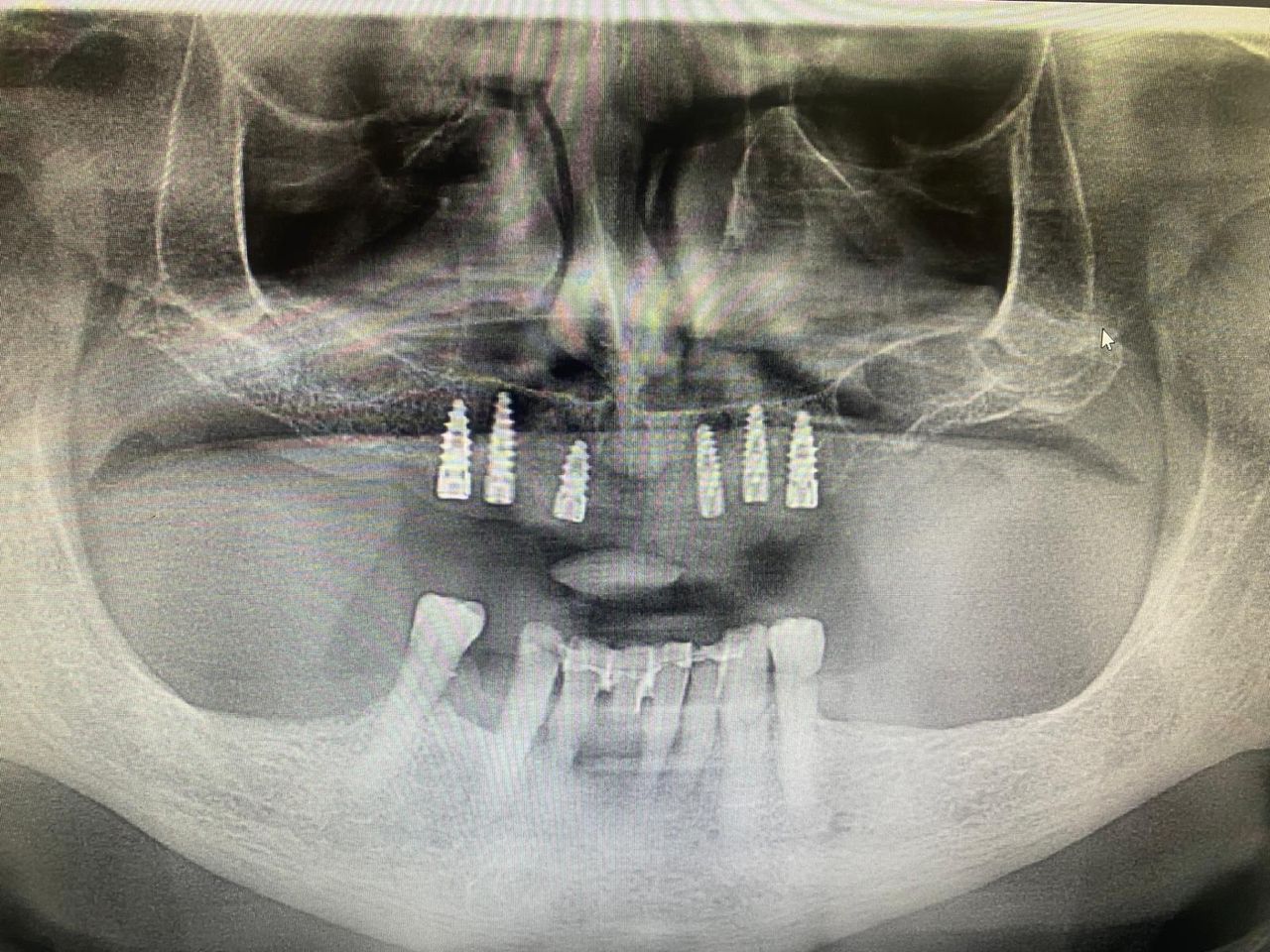 Luigi Giuseppe Romano-18