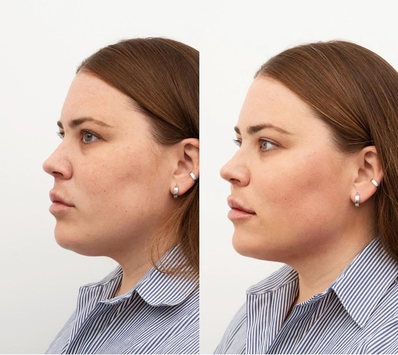 Raquel Moreno Pentinel-63