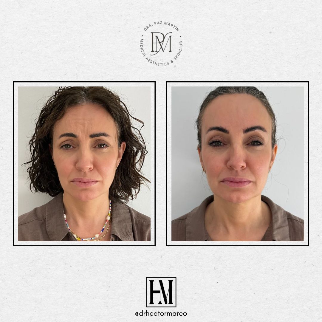 Héctor Marco Ruiz-9