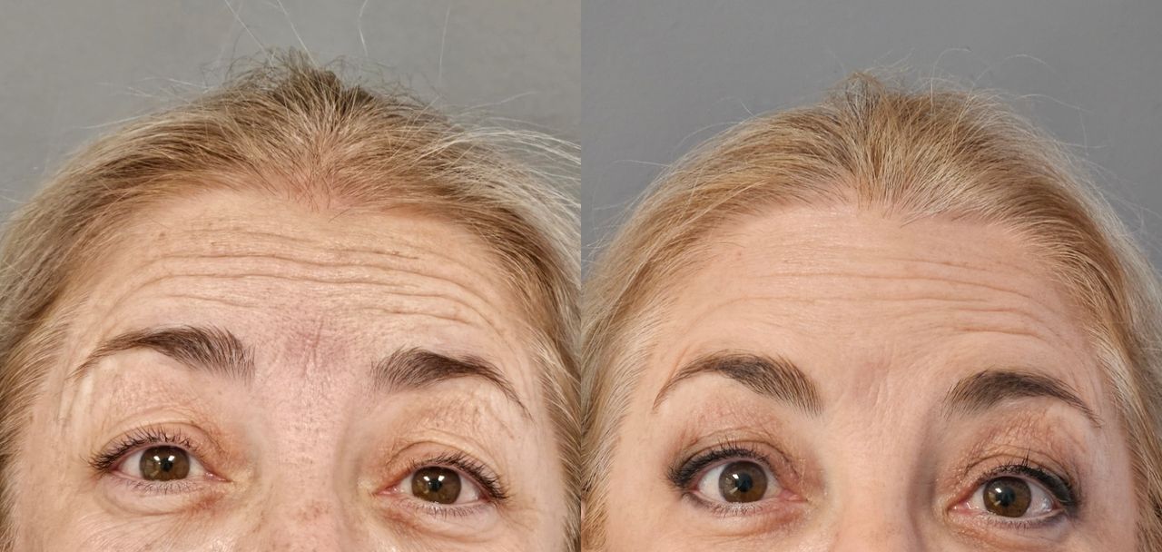 Rosalba Herrero Zerpa-547