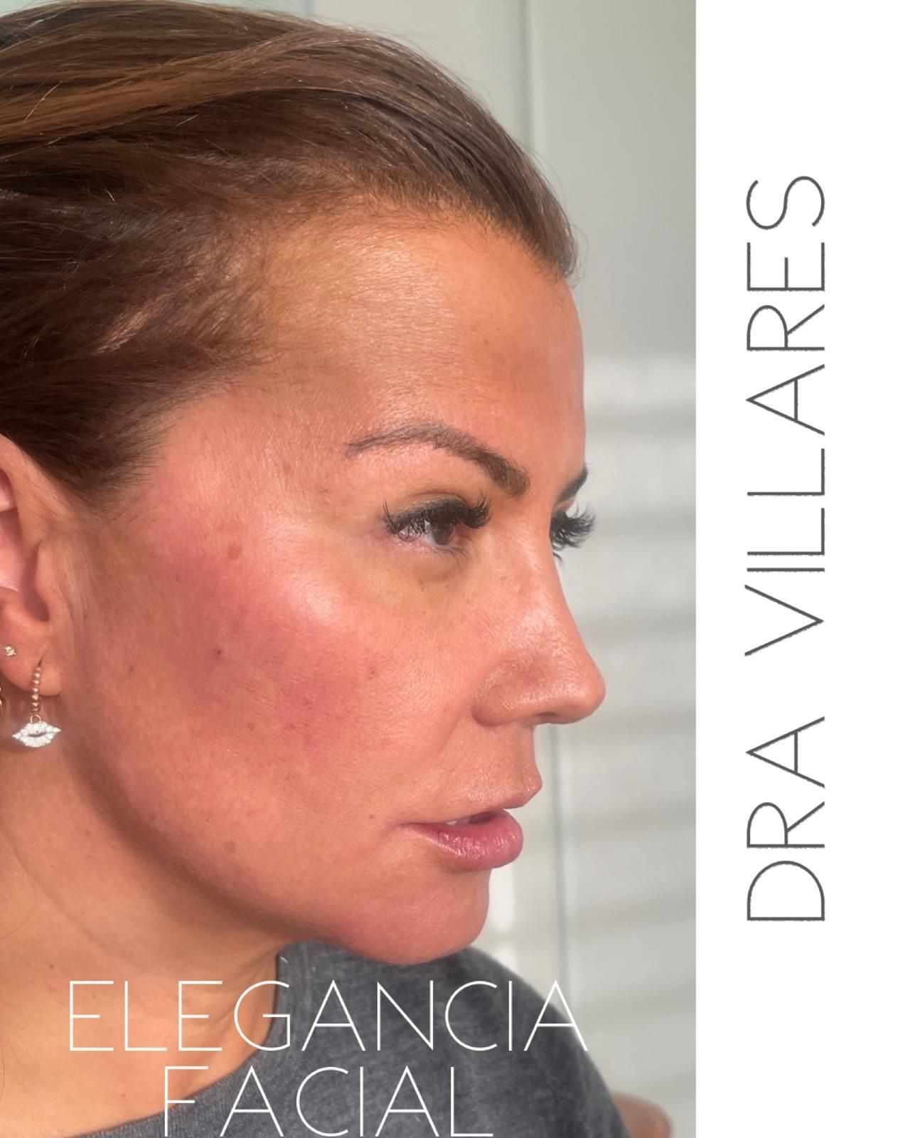 Maria Jose Villares Moreno-12