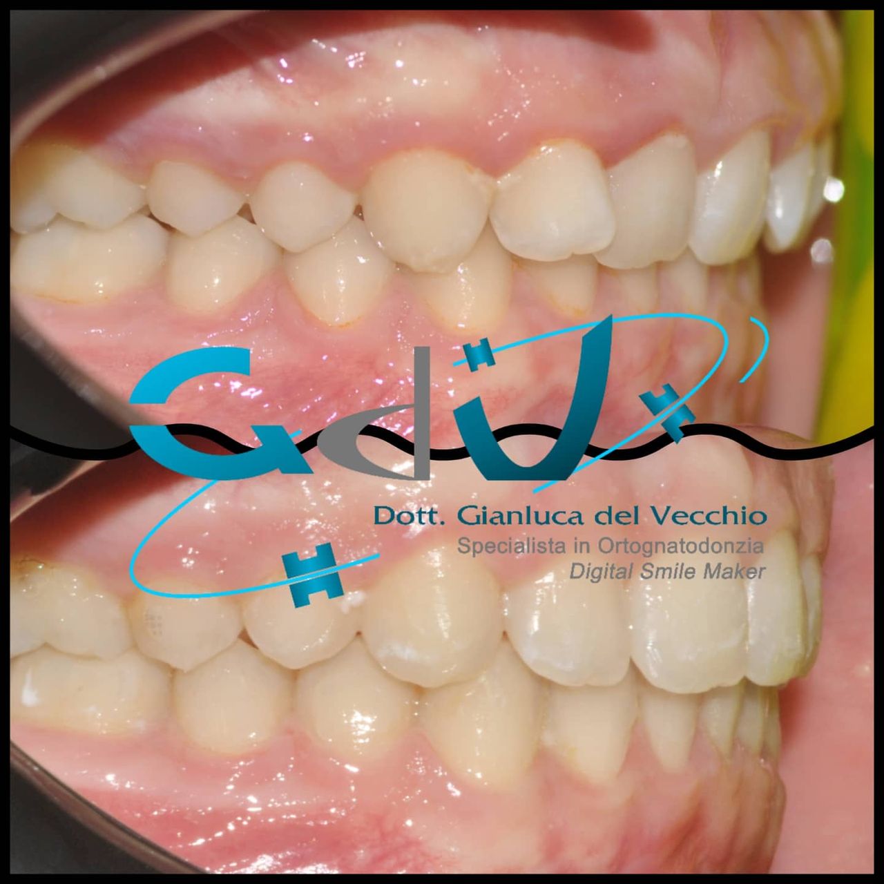 Gianluca Del Vecchio-165