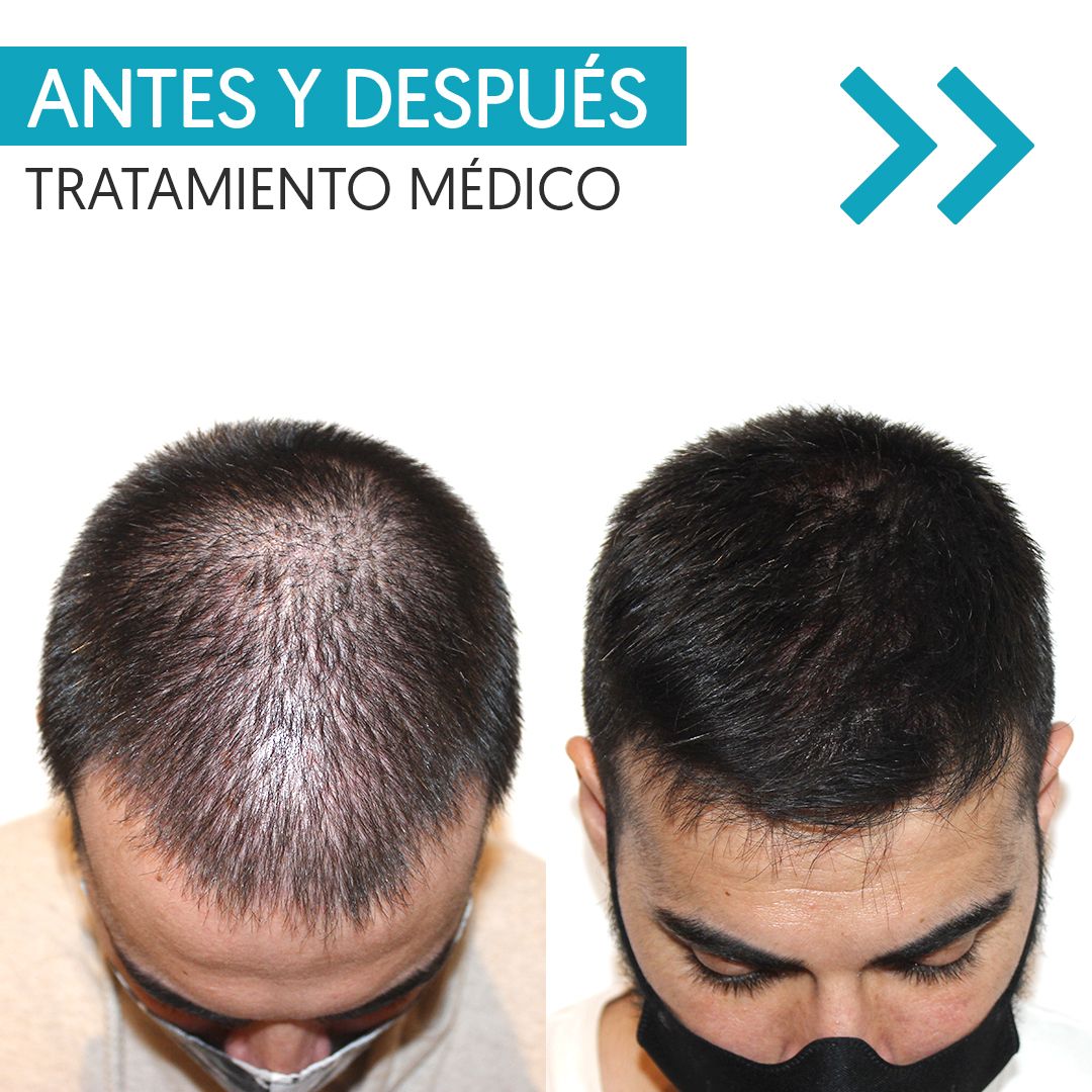 Karlexis León Montilla-14