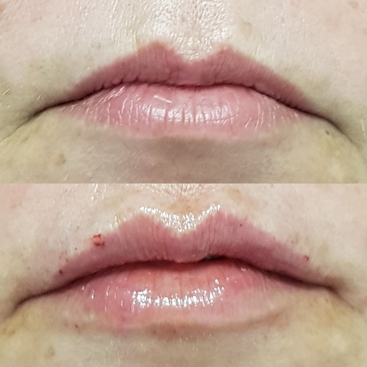 Rosalba Herrero Zerpa-335