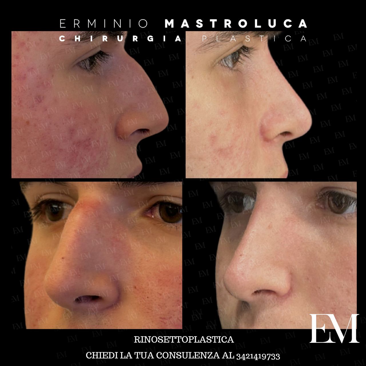 Erminio Mastroluca-18