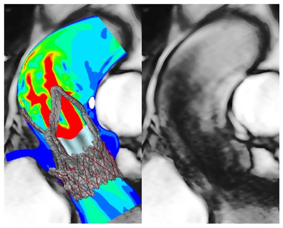 Alessandro Sticchi-17