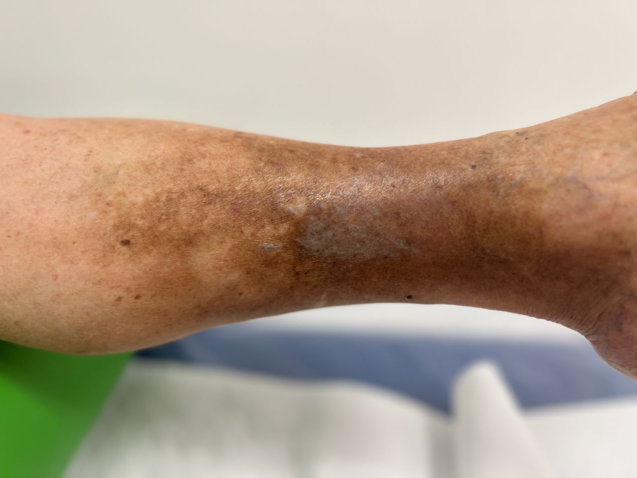 Luciano Allegretti-32