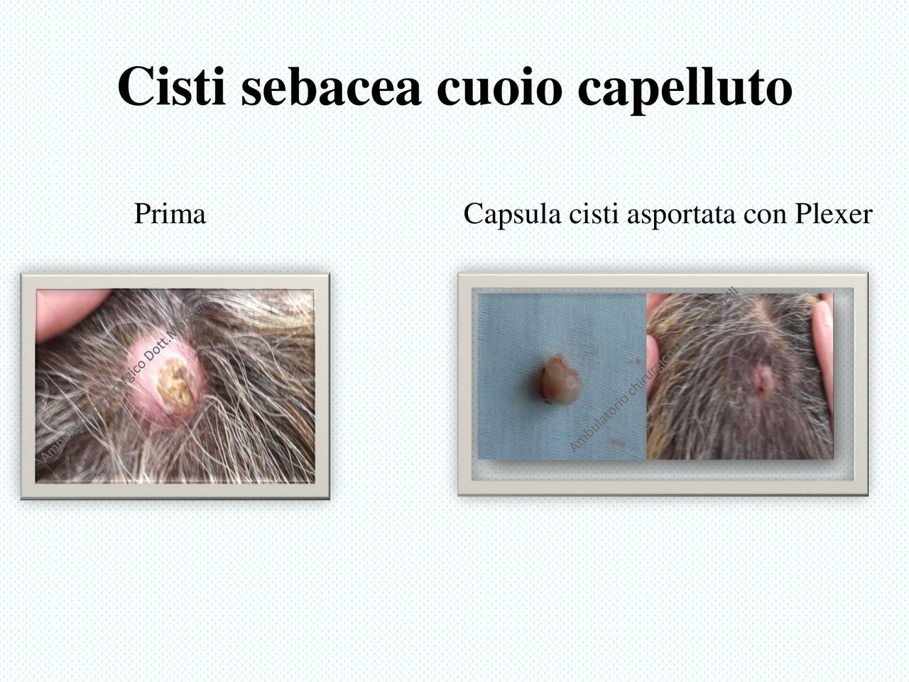 Matteo Antonio Mongelli-6