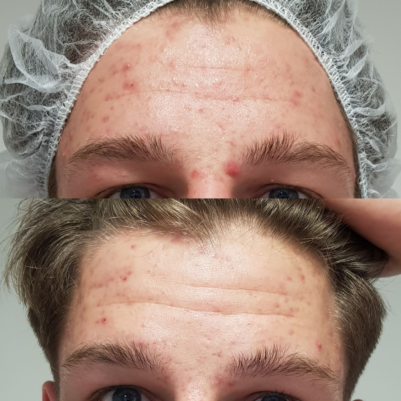 Rosalba Herrero Zerpa-290