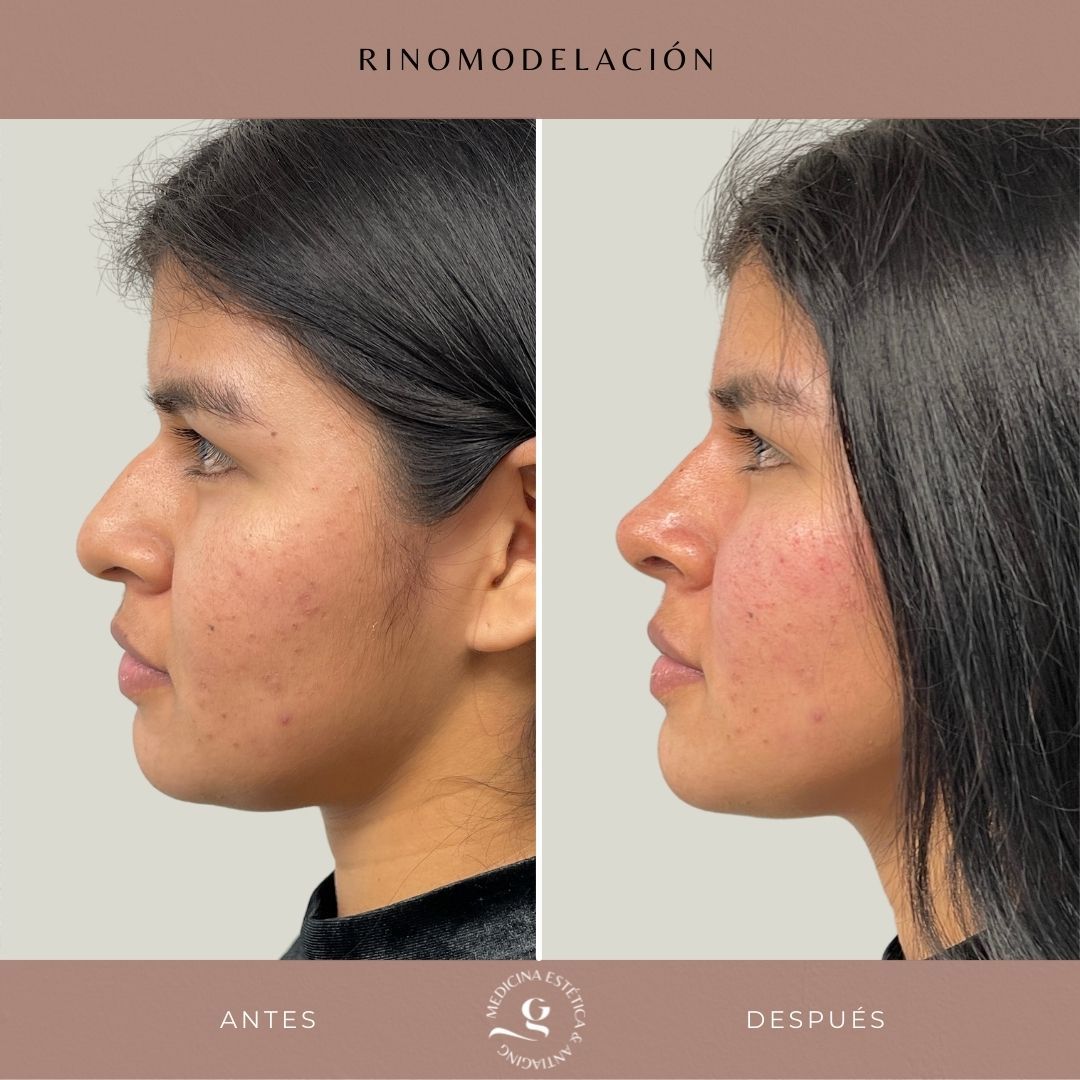 ​Giovanni Giorgianni-32