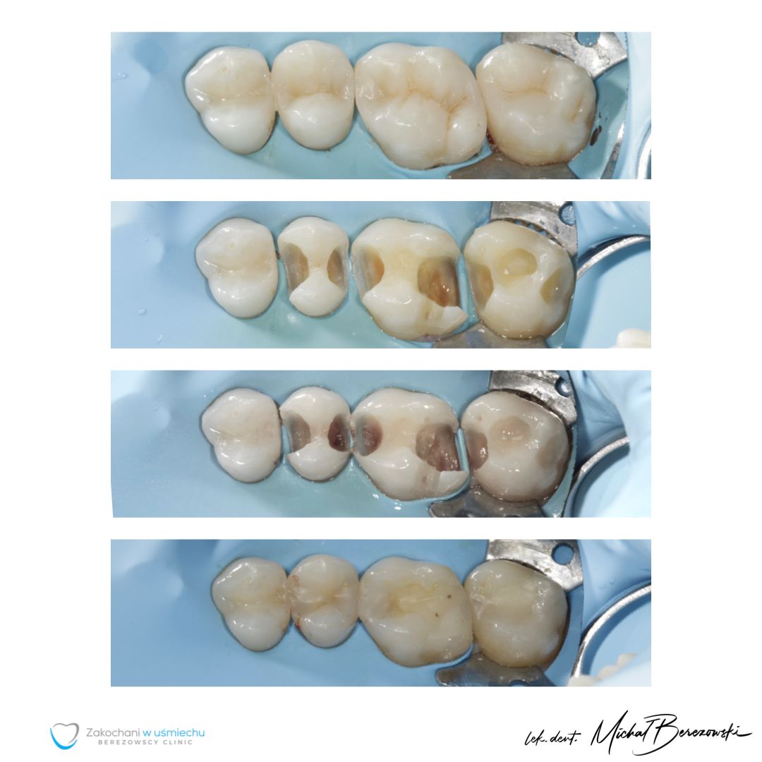 Michał Berezowski-10