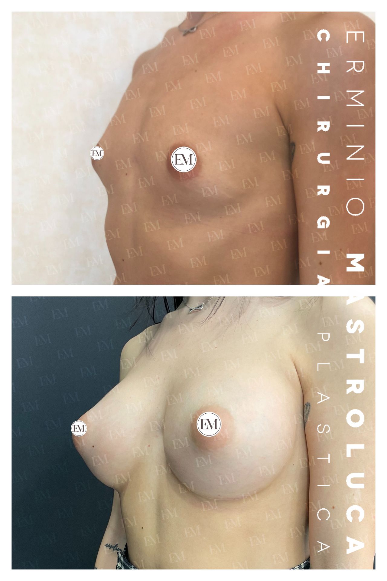 Erminio Mastroluca-8