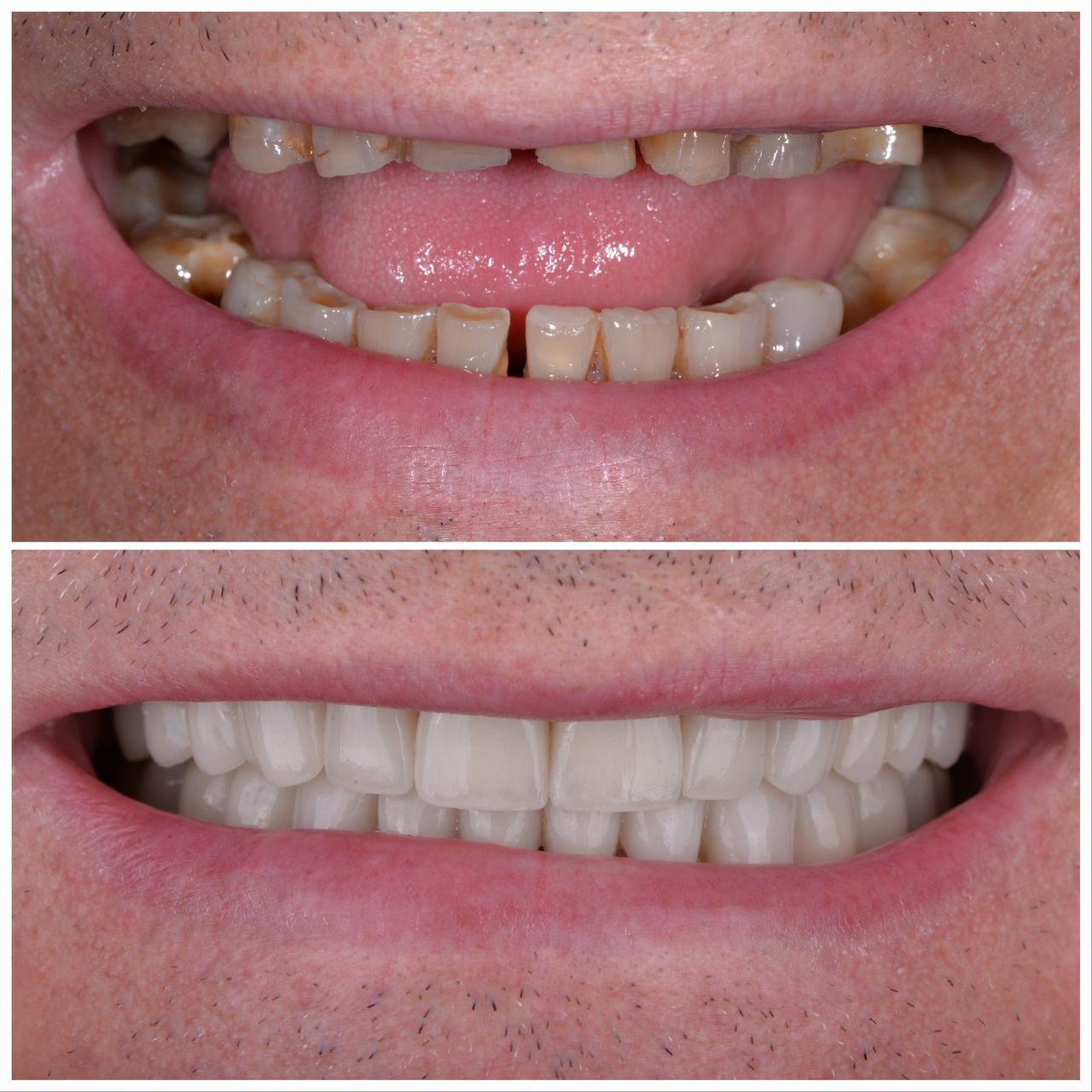 Martin Bartoszcze-32