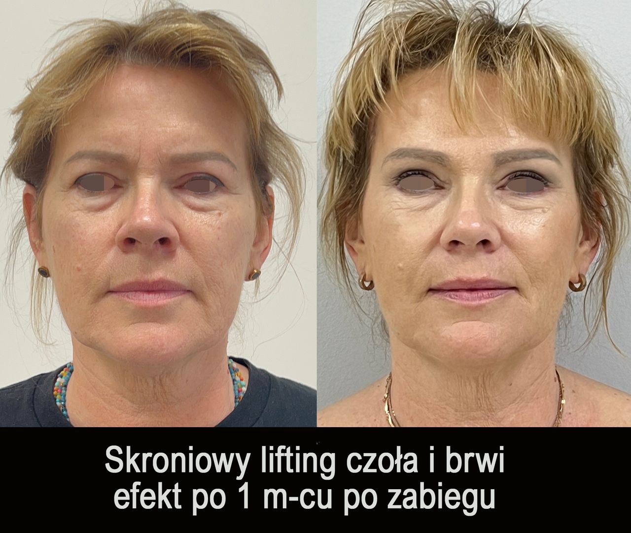 Mariusz Zagajewski-43