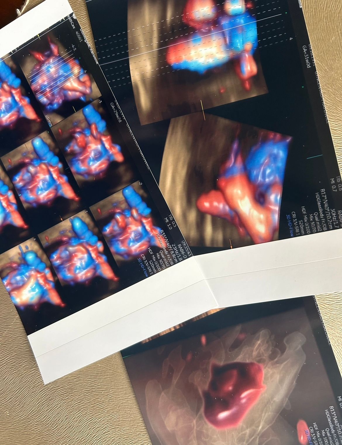 Wioletta Rozmus-Warcholińska-141