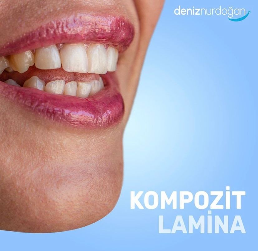 Deniz Nurdoğan Derbeder-3