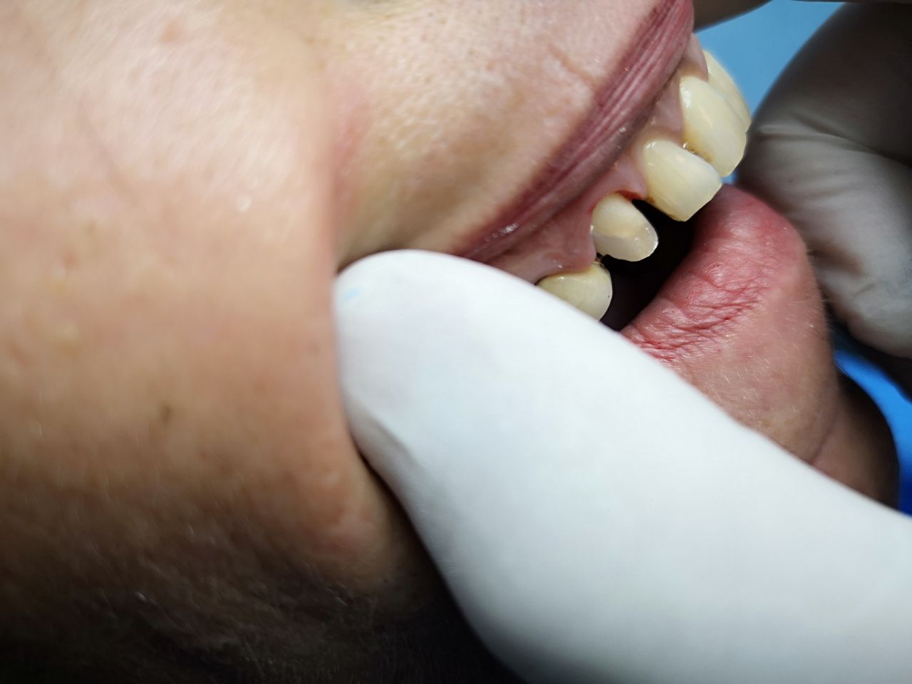 Stefano De Simone-42