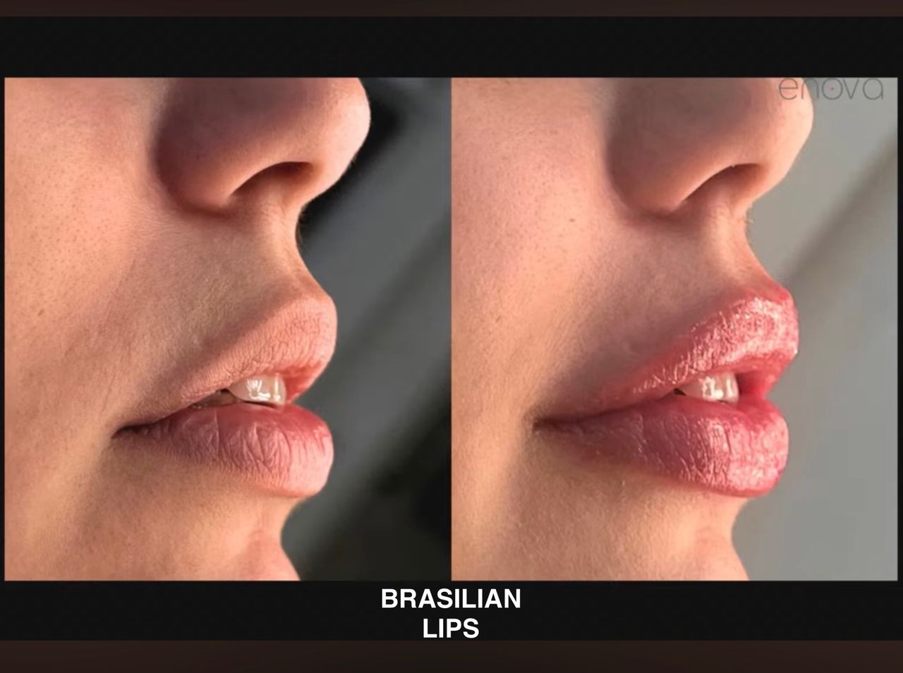 Arsenio Menchero Sánchez-36