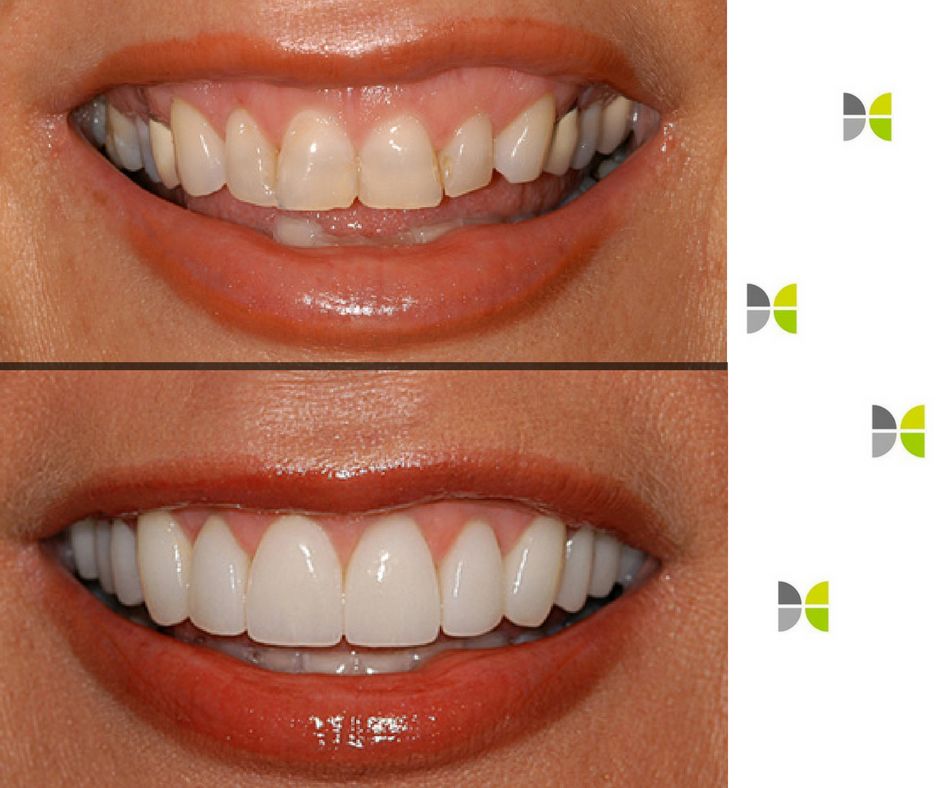 Łukasz Wojszwiłło-33