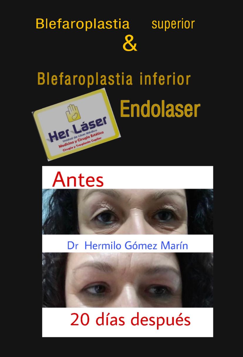 Hermilo Gomez Marin-0