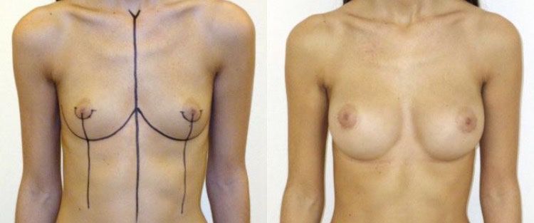 Pasquale Virciglio-24