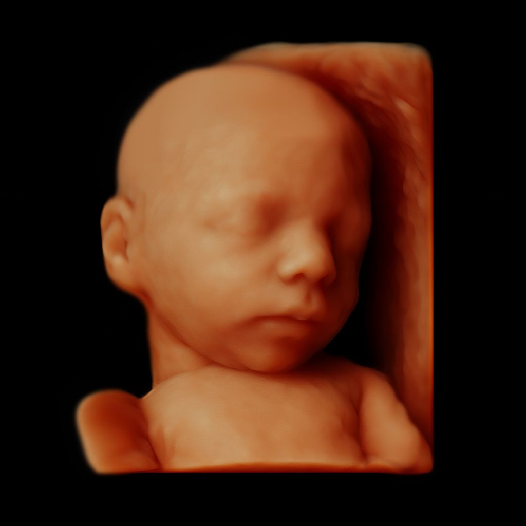 Pier Luigi Salzillo-1