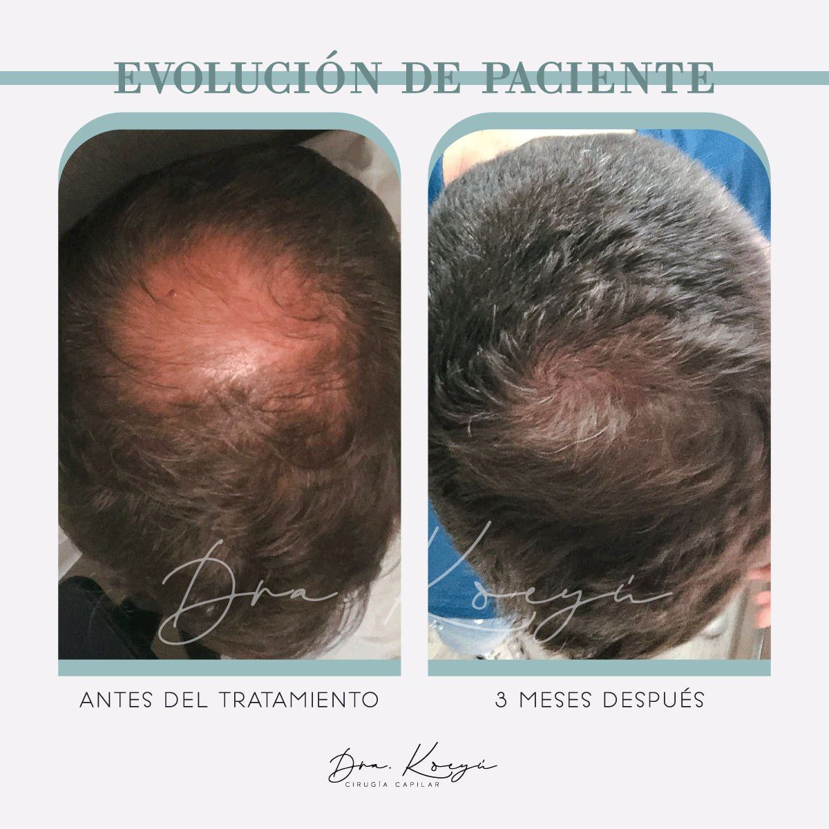 Carmen Orozco Bello-0