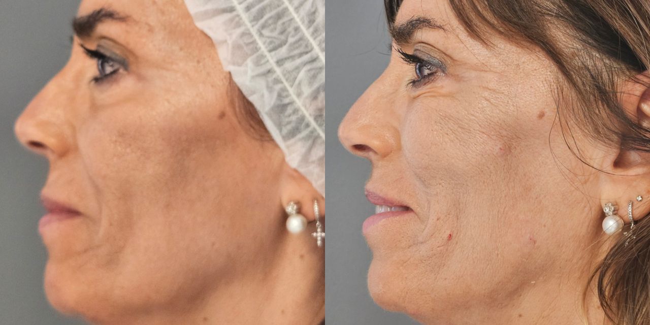 Rosalba Herrero Zerpa-34