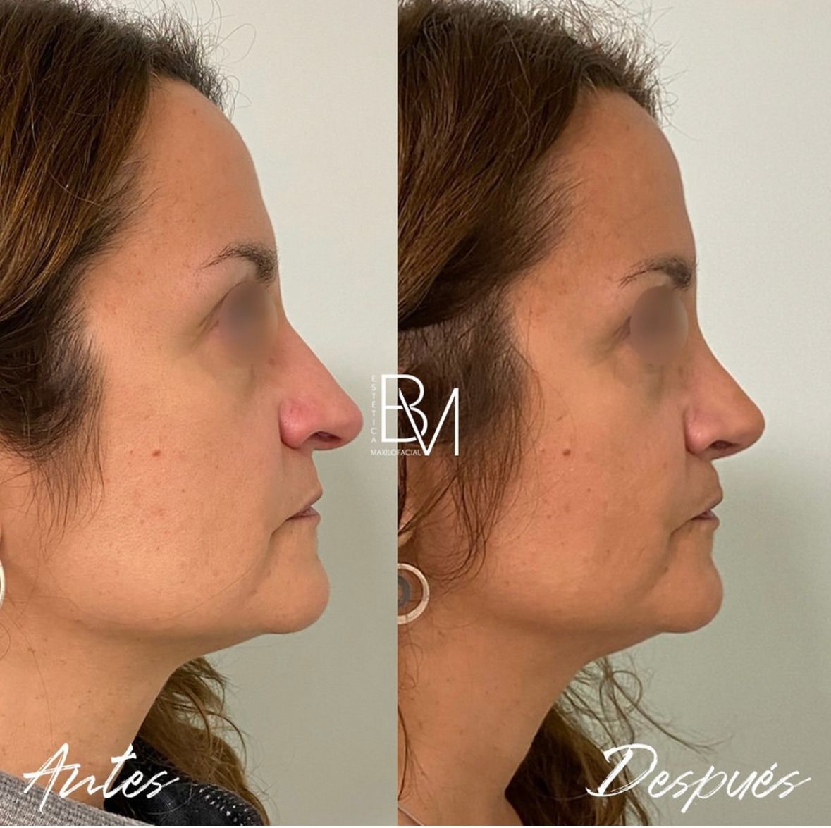 Beatriz Moralejo-61