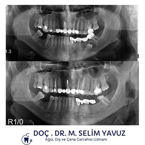 Muhammed Selim Yavuz-15
