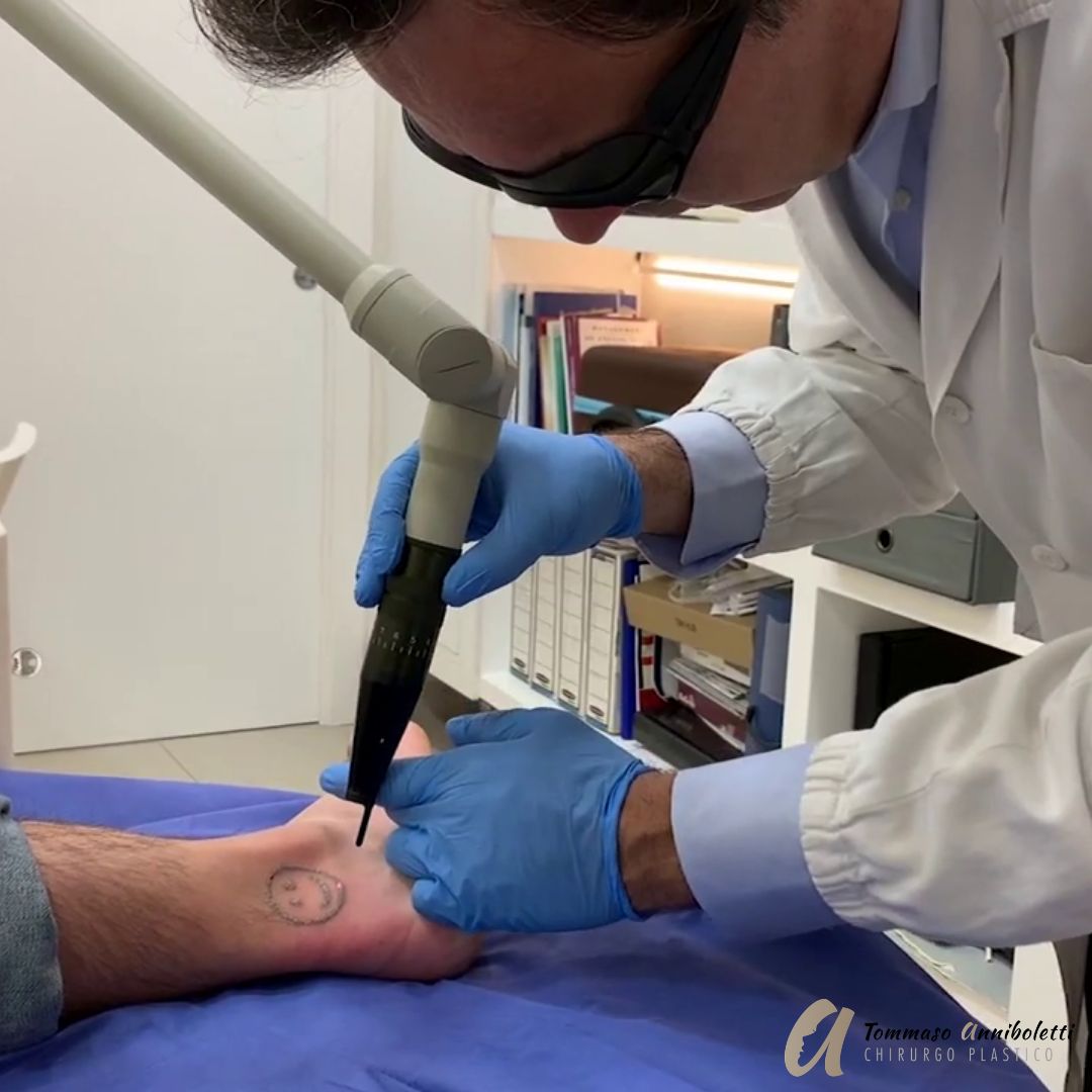 Tommaso Anniboletti-20