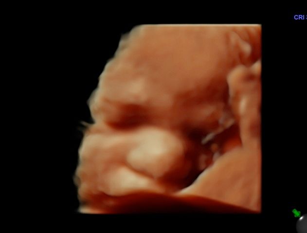 Tommaso Incandela-61