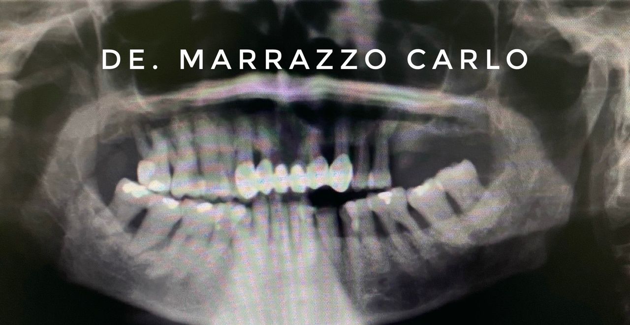 Carlo Marrazzo-44